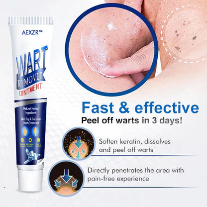 Crema Quita Verrugas Wart Blackheads