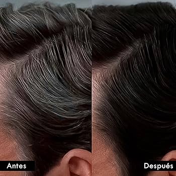 Sh Secreto Angeles ➕ Colageno ➕ Exfoliante GRATIS🎁- Cubre las canas desde la PRIMERA aplicación ✨DSTO 30%